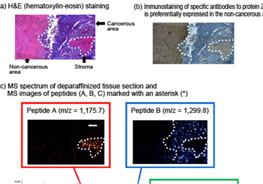 石蜡包埋组织切片的质谱成像