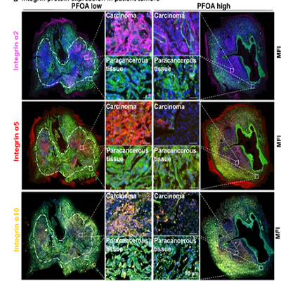 前沿合作|环境污染物的暴露与健康影响研究取得新进展