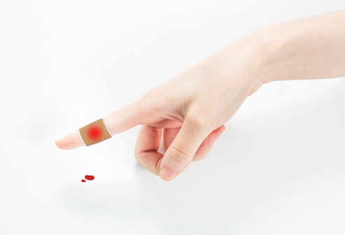 新方法丨血友病“救命药”——人凝血因子VIII中聚合物杂质分析